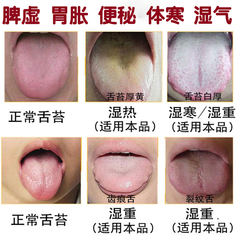 胃胀气不消化是怎么回事