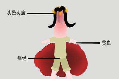 来月经时头疼是怎么回事