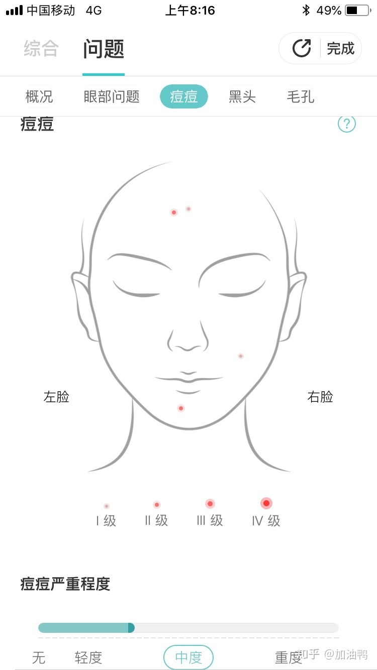 额头右边疼是怎么回事