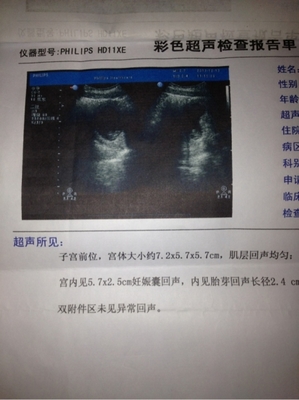 怀孕可以考驾照吗
