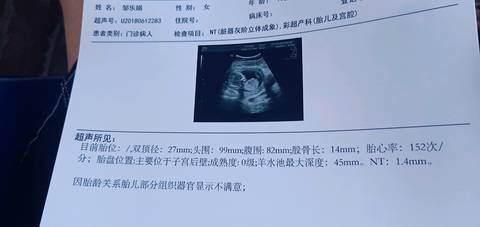 围排卵期是什么意思