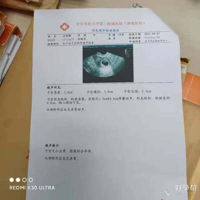 怀孕多久可见孕囊