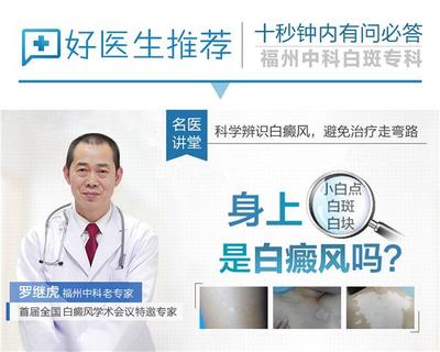 白癜风该怎么治疗好