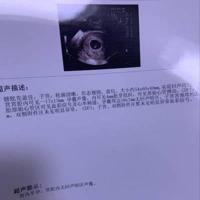 孕9周胎儿