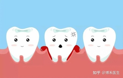 牙根出血是怎么回事