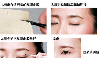 如何有双眼皮