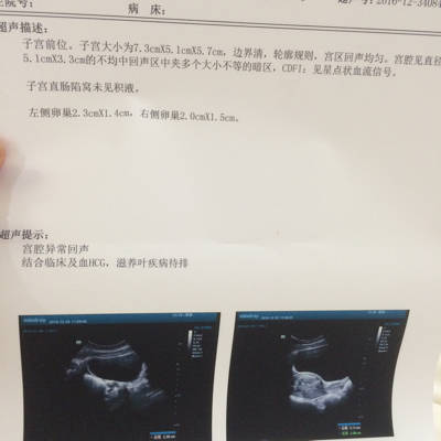 怀孕初期少量出血正常吗
