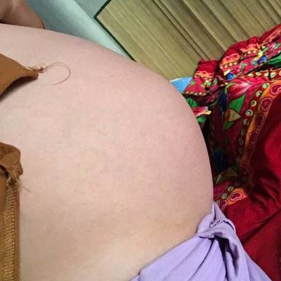 1岁宝宝肚子大正常吗