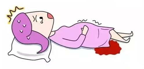 临产出血是怎么回事