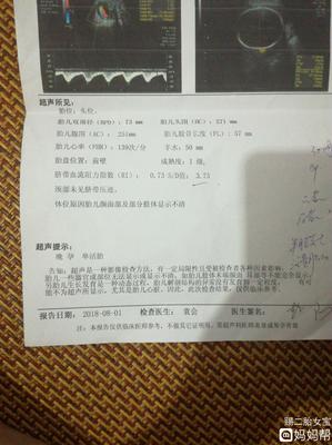 胎儿sd值偏高怎么回事
