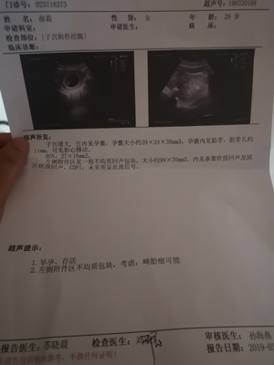 怀孕4个月能做流产吗