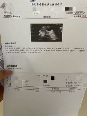 怀孕去检查要多少钱