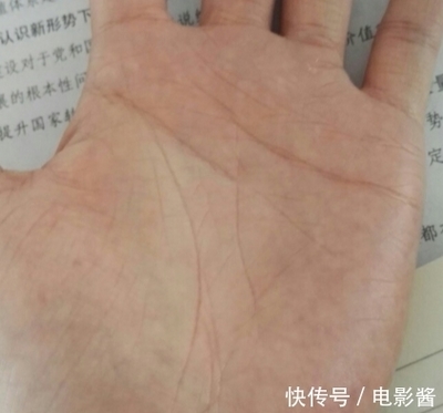 婚姻线有痣