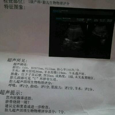30周胎儿图片