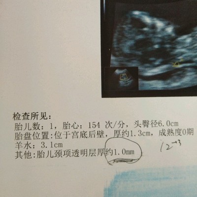 胎盘后壁几个月显怀