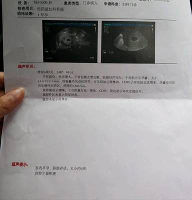 怎么确定是不是怀孕了