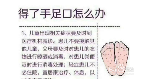 儿童手足口病怎么治疗