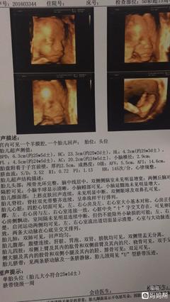 怀孕六个月做四维晚吗