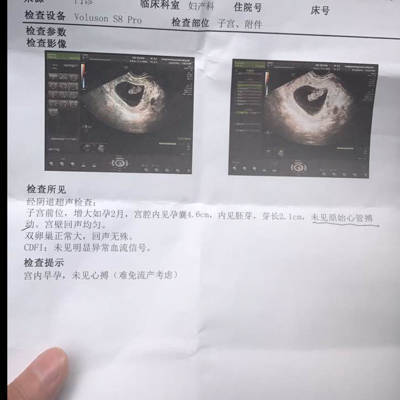 一般怀孕多久有心跳