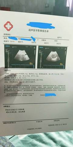 孕35周几个月