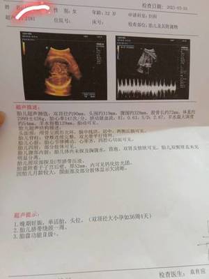 胎儿35周发育标准数值