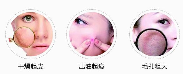 用水光针会起痘痘