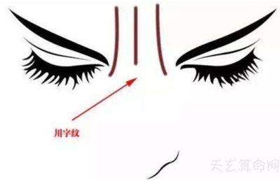 眉间纹的面相图解