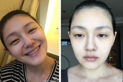 双眼皮不明显咋办