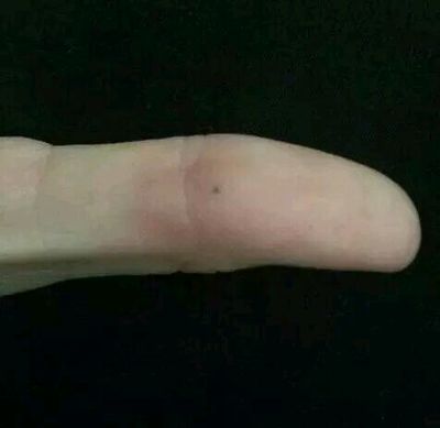 铅笔留下黑点怎么办