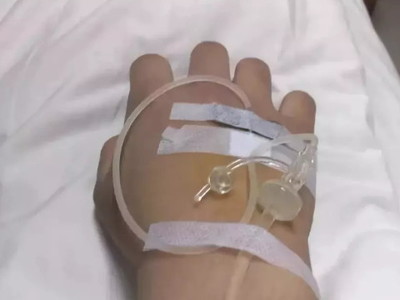 梦见自己在输液