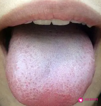 舌苔发绿是怎么回事