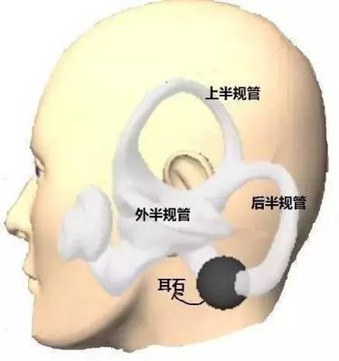 前庭功能眩晕怎么治疗