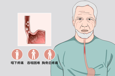 食道疼是怎么回事