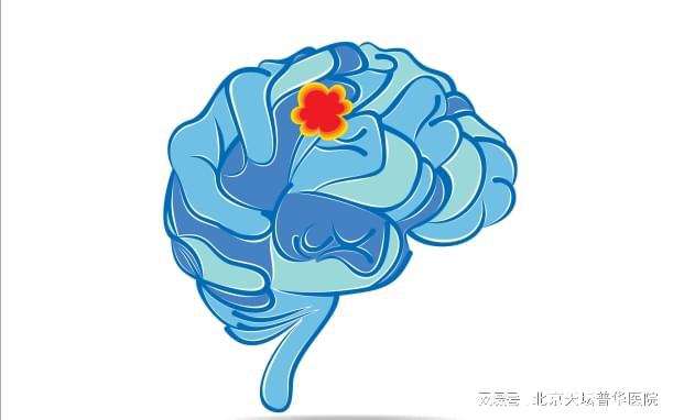 脑瘤怎么治疗最好