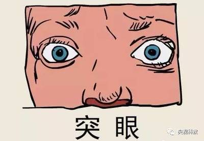 得了甲亢怎么治疗