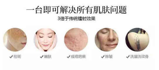 皮秒祛斑对皮肤有伤害吗
