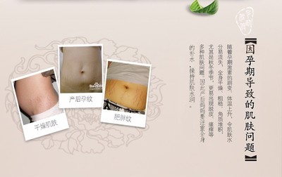 母乳可以用来做身体乳吗?凡士林身体乳可以在哺乳期使用吗?