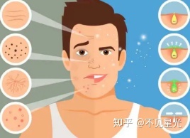 闭口粉刺很深发不出来