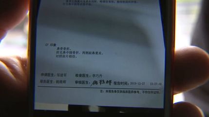 鼻骨骨折赔偿