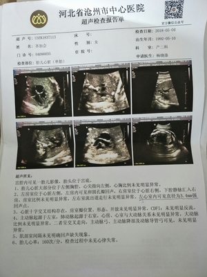 怀孕六个月查什么项目