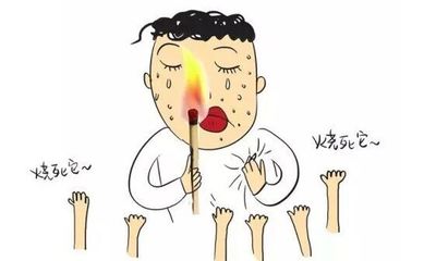 哪种洗面奶祛痘好
