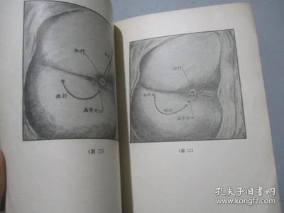痔漏是怎么回事