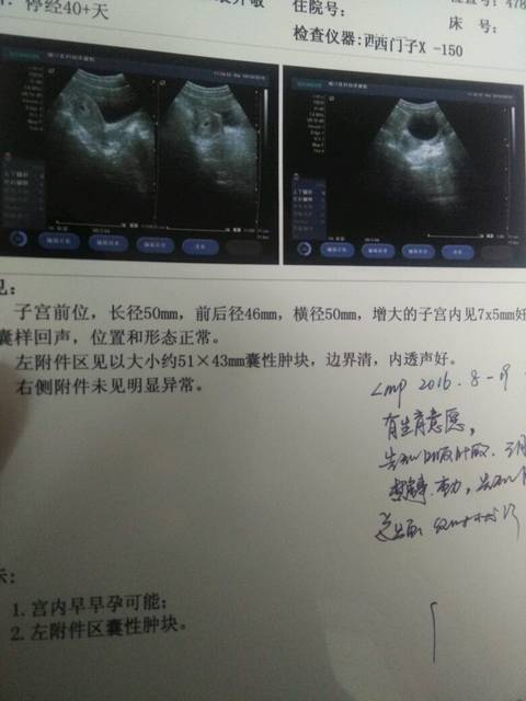 怀孕四十天需要做什么检查