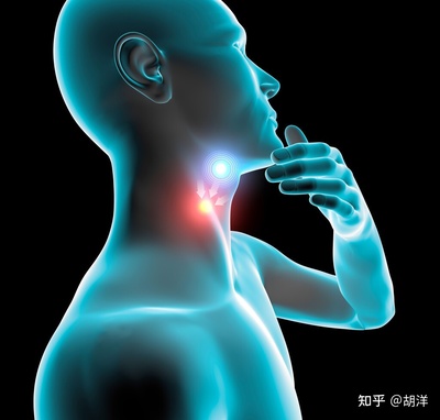 咽喉淋巴滤泡增生怎么治疗