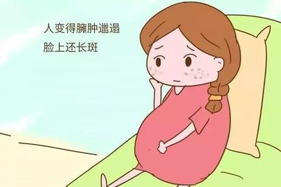 怀孕后长斑是什么原因