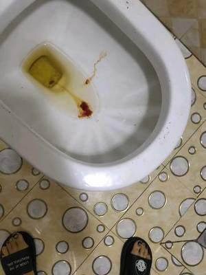 小便是红的是怎么回事