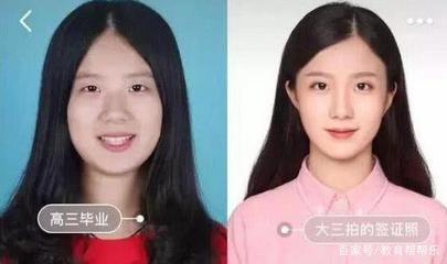 整容双眼皮的危害