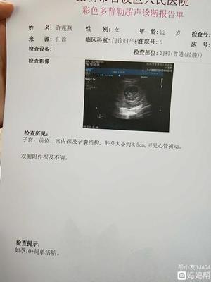 怀孕10周图片