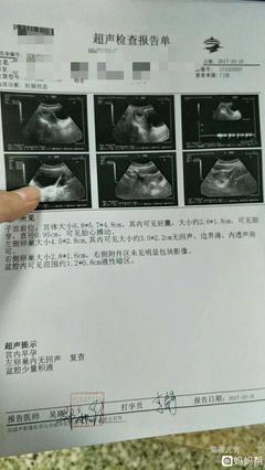 怀孕7周有胎心胎芽吗