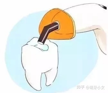 补牙后隐隐作痛
